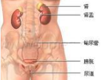 <b>尿道炎要注意些什么</b>