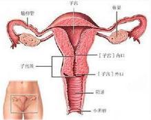 宫颈囊肿是怎样导致女性不孕的？