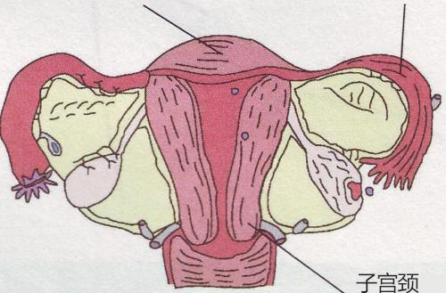 宫颈出血是宫颈糜烂变严重了吗