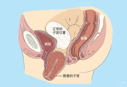 淮安哪家医院治疗宫颈肥大好?妇科医院是选择!