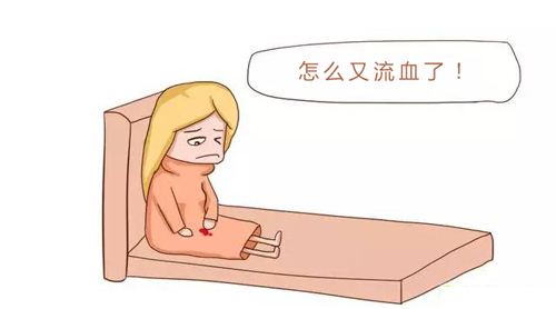 女人宫颈出血的原因是什么