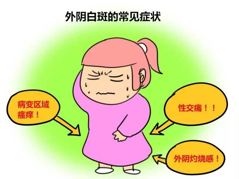 女性患外阴白斑会有什么症状呢