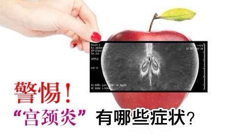 四大症状提醒你,宫颈炎在靠近