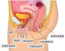 女性尿道炎有什么症状，你是不是也出现了？