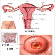 1度宫颈糜烂的治疗医院_淮安治疗糜烂的价格