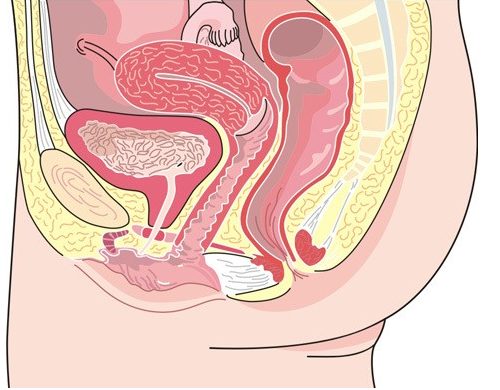 膨腔炎积液怎么治疗