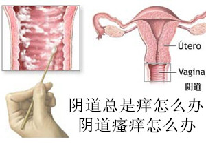 阴道总是痒怎么办,6个缓解阴道瘙痒的小妙招