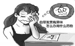 白带发黄有异味怎么办用什么药物【治疗白带异常的攻略】