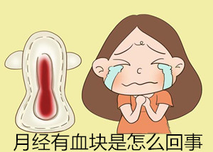 月经有血块是怎么回事【天了噜】我是不是得了妇科疾病