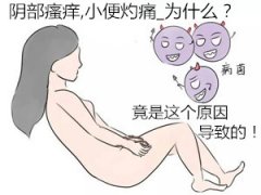 阴部瘙痒,小便灼痛_为什么？竟是这个原因导致的！