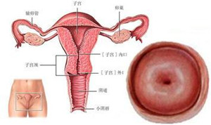 【惊人】宫颈肥大是怎么回事★对女性的危害竟不止这些
