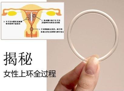 女性上环要走什么程序★【医生揭秘上环的全部步骤】