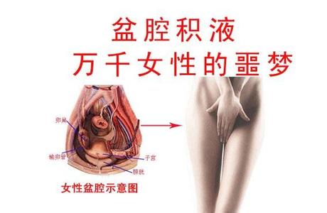 警惕!【盆腔积液表现】3大异常表现,快来对号入座!
