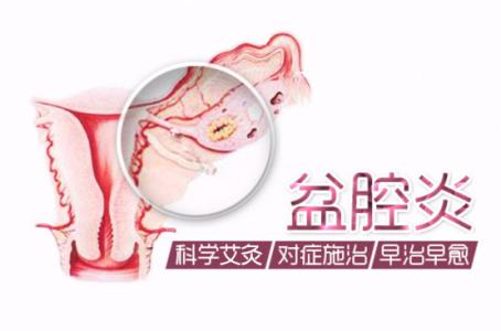 【盆腔炎怎么检查】揭秘4大盆腔炎检查方法！