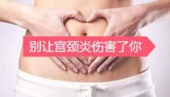 【慢性宫颈炎怎么治疗】3种宫颈炎治疗方法!一定要收了！