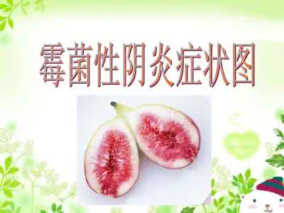 【霉菌性阴炎的症状】3个霉菌性阴道炎的小常识！