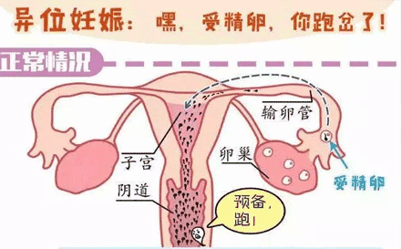 急性盆腔炎小腹疼痛怎么办？3种方法，拒做“炎”女郎！