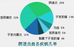 非月经期阴道出血是怎么回事_可怕这5类疾病可致阴道出血！