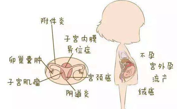 淮安看个妇科病多少钱啊?主要花费体现在三方面