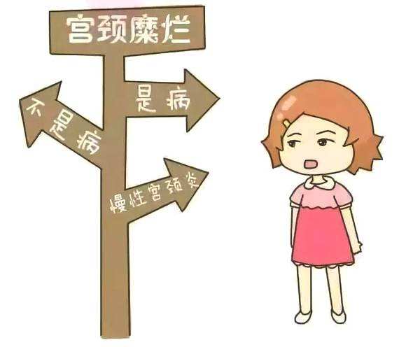 宫颈糜烂治疗佳时间？