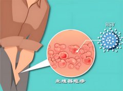 男人前列腺是什么原因引起的