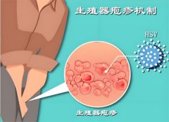 男性生殖有水泡是怎么回事