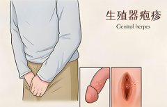 男性生殖感染是怎么造成的