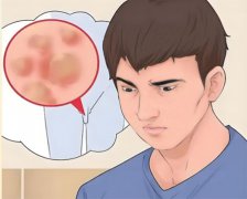 男性怎么检查hpv有没有感染
