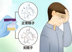 无生育能力的男人表现