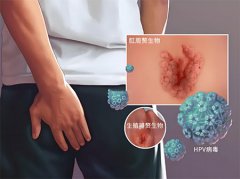 男性生殖感染有什么症状