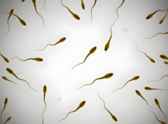 精子发黄是死精吗
