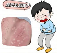 阴囊处长了个疙瘩该怎么办