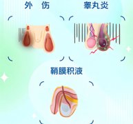 阴囊肿胀是怎么回事儿