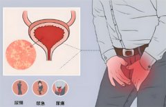 尿路感染是怎么引起的