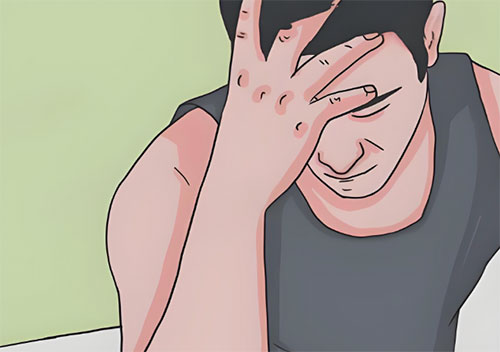 三秒射还能治疗吗