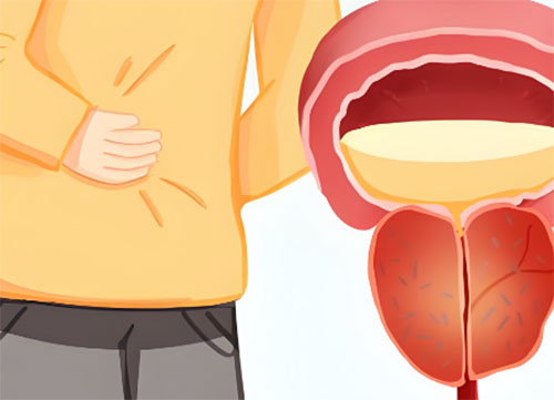 前列腺钙化怎样能消失