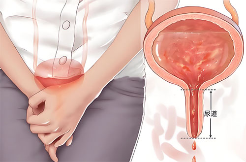 男性尿道口肿了像嘴唇怎么办