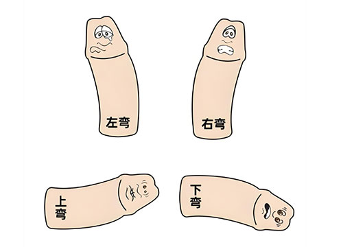 丁丁弯了怎么自己矫正