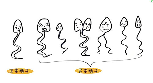 精子畸形率高怎么治疗