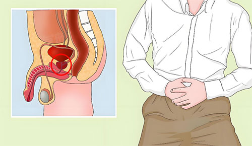 前列腺增生怎么治疗效果好