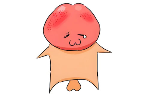 龟头上红肿用什么药好的快