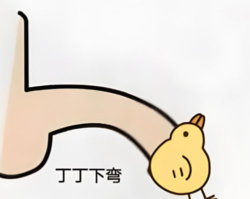 丁丁弯曲多少度正常