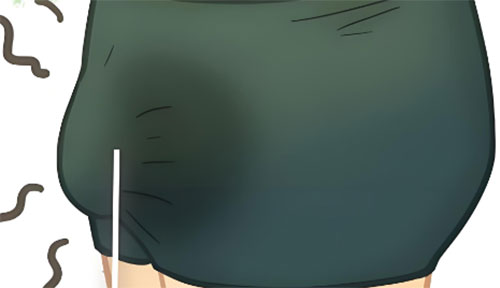 龟头上痒用什么药好得快一点