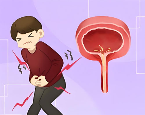  男性尿道炎有哪些症状