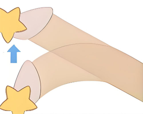 丁丁弯了能变直吗