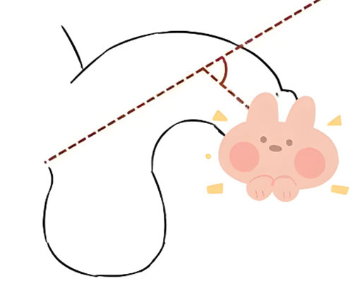 丁丁弯曲怎么回事还能变直吗