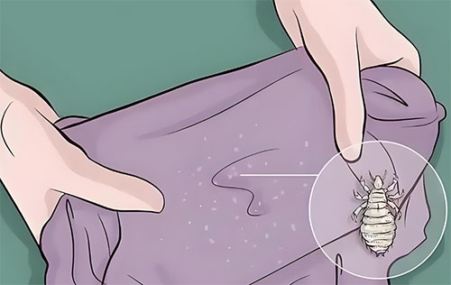 阴虱是什么原因得的