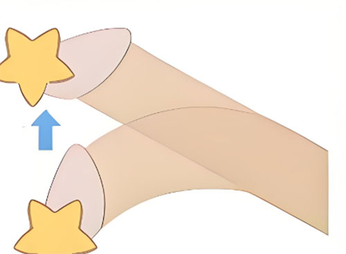 勃起向左弯曲30度能自己好吗