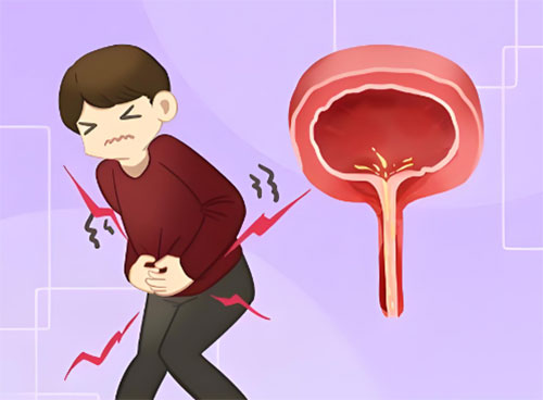 男性尿道炎症状表现有哪些