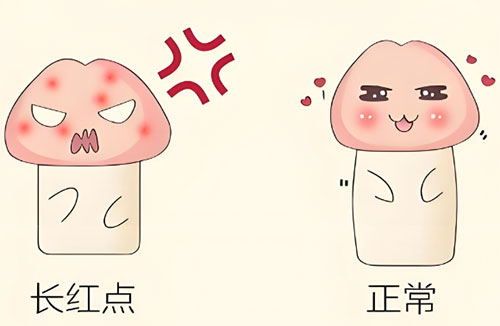 龟头上有小红点是什么病